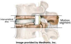 Lumbar_motion-segment